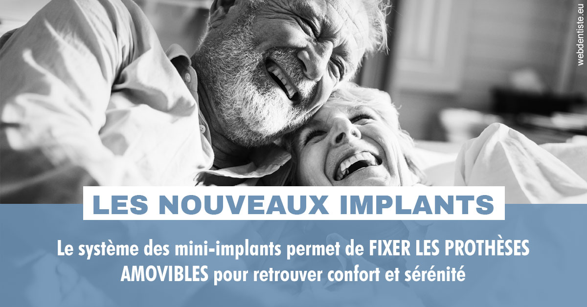 https://dr-arnaud-lecauchois.chirurgiens-dentistes.fr/Les nouveaux implants 2