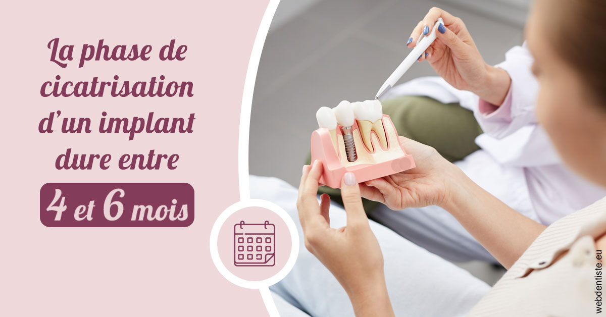 https://dr-arnaud-lecauchois.chirurgiens-dentistes.fr/Cicatrisation implant 2