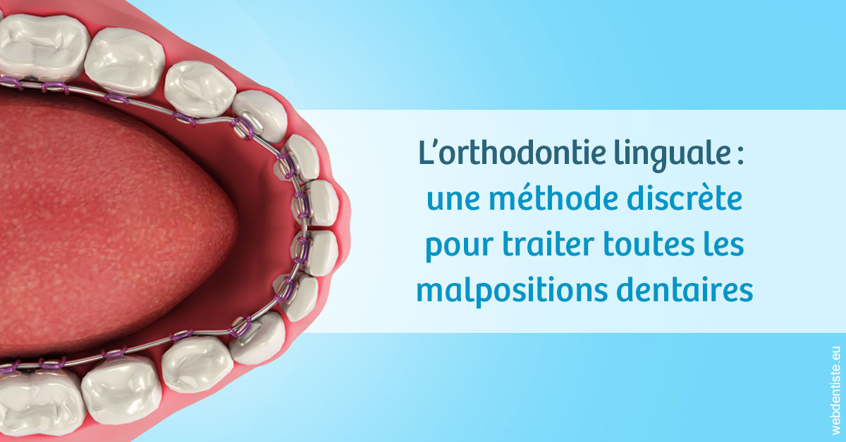 https://dr-arnaud-lecauchois.chirurgiens-dentistes.fr/L'orthodontie linguale 1