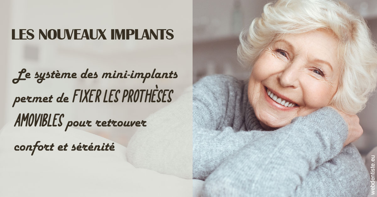 https://dr-arnaud-lecauchois.chirurgiens-dentistes.fr/Les nouveaux implants 1