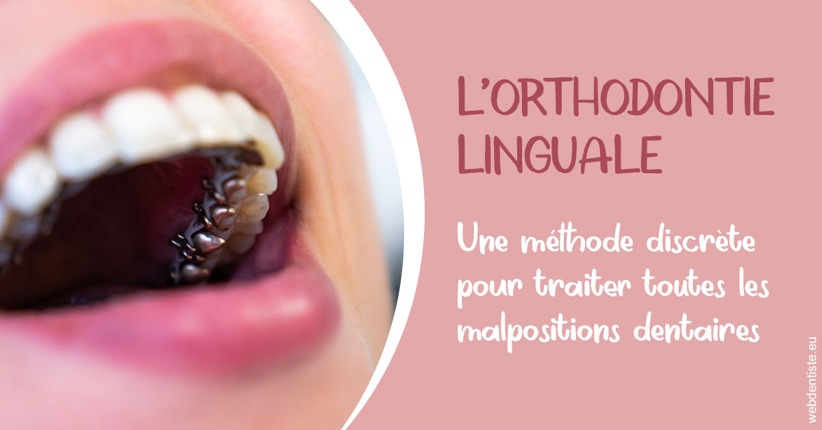 https://dr-arnaud-lecauchois.chirurgiens-dentistes.fr/L'orthodontie linguale 2