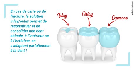 https://dr-arnaud-lecauchois.chirurgiens-dentistes.fr/L'INLAY ou l'ONLAY
