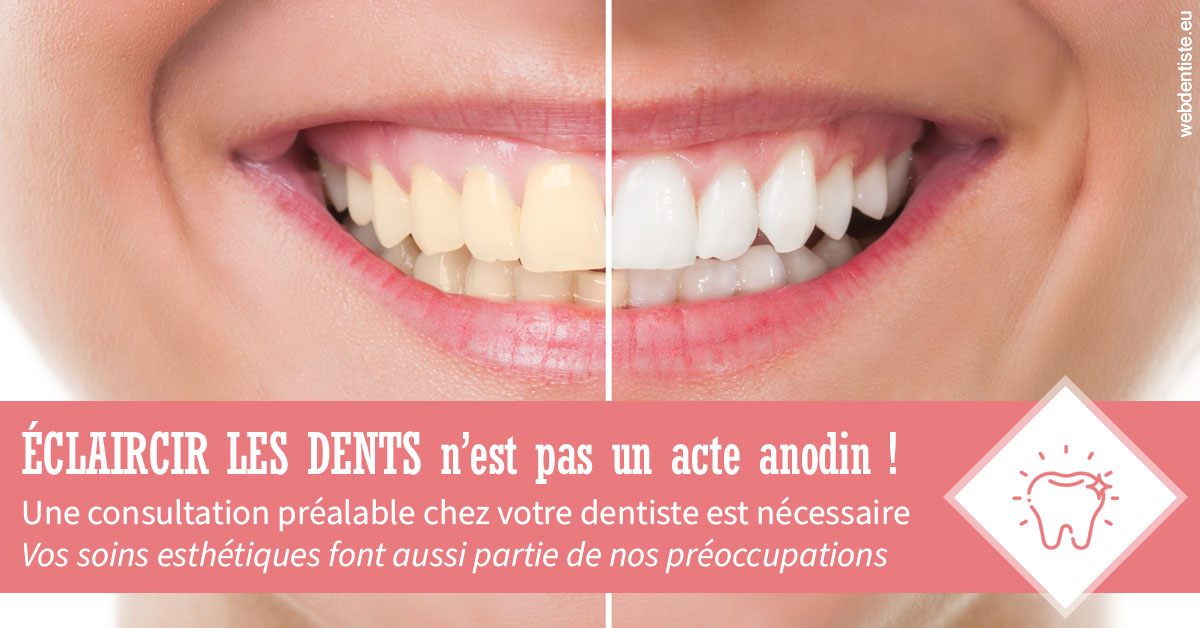 https://dr-arnaud-lecauchois.chirurgiens-dentistes.fr/Eclaircir les dents 1