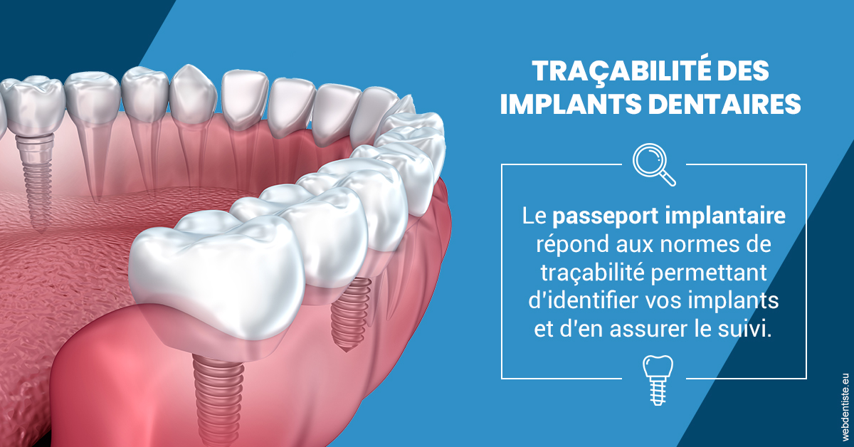 https://dr-arnaud-lecauchois.chirurgiens-dentistes.fr/T2 2023 - Traçabilité des implants 1
