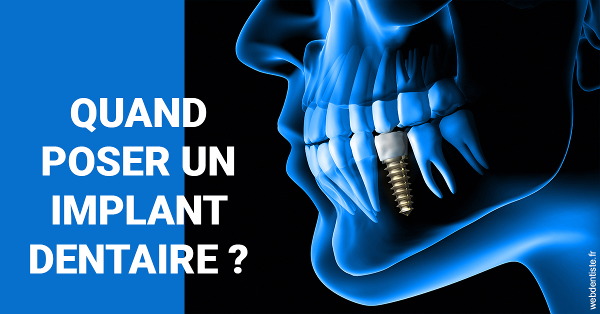 https://dr-arnaud-lecauchois.chirurgiens-dentistes.fr/Les implants 1