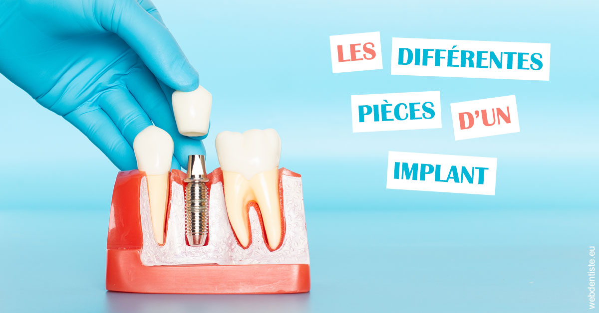 https://dr-arnaud-lecauchois.chirurgiens-dentistes.fr/Les différentes pièces d’un implant 2