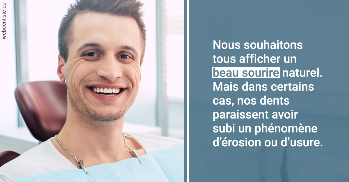 https://dr-arnaud-lecauchois.chirurgiens-dentistes.fr/Érosion et usure dentaire