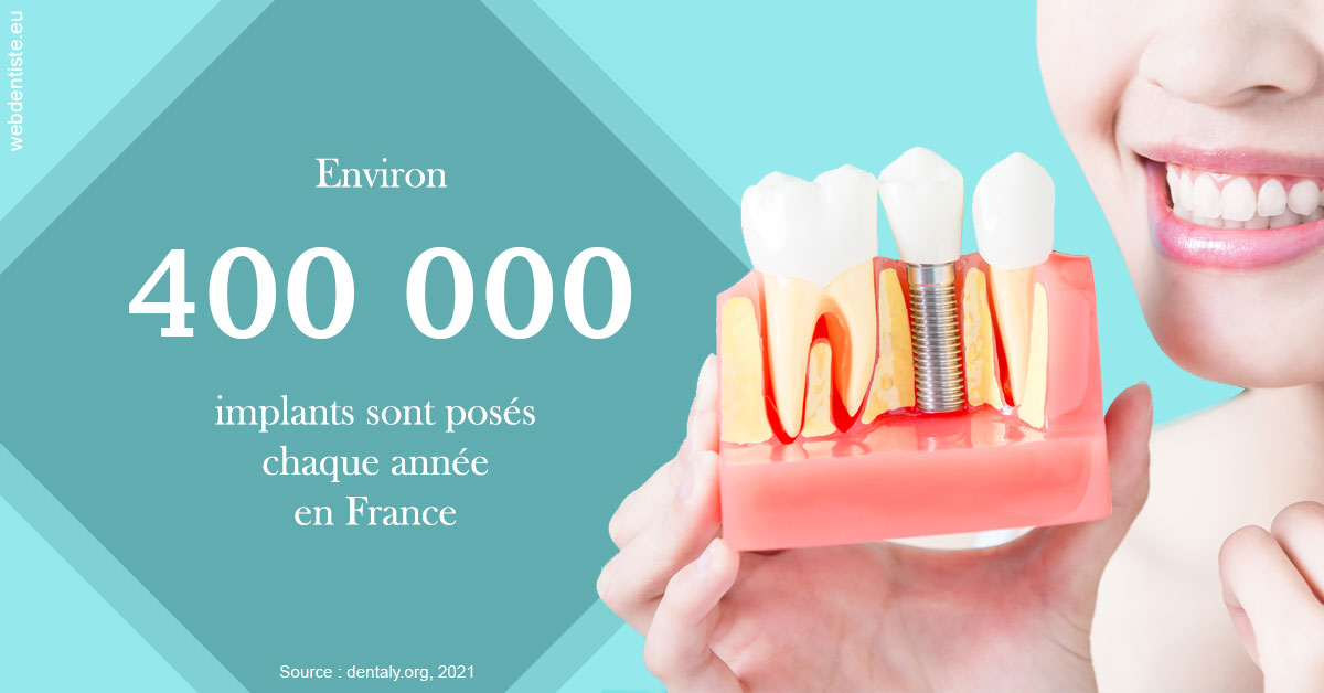 https://dr-arnaud-lecauchois.chirurgiens-dentistes.fr/Pose d'implants en France 2
